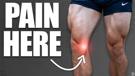 acl mcl tear test|acl mcl tears exercises guide.